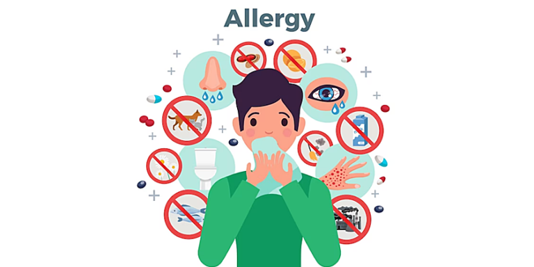アレルギー・花粉症
