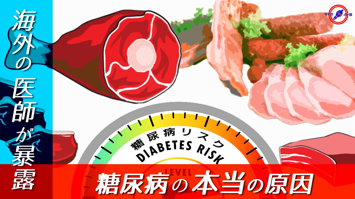 糖尿病 の 原因 Causes of diabetes