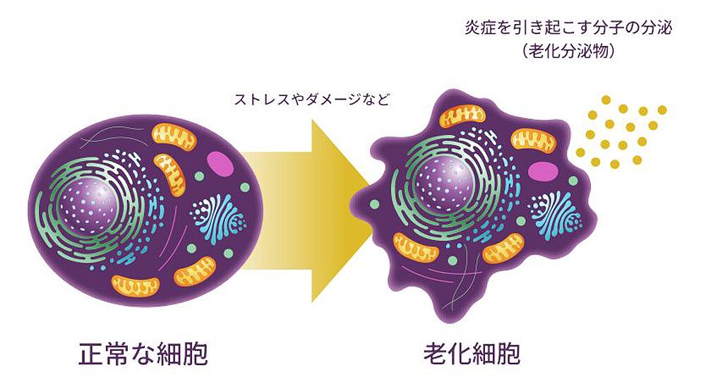 老化分泌物 で周囲の細胞も老化が進む