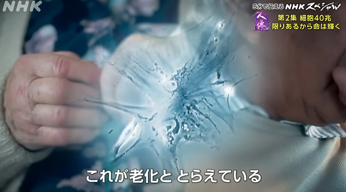 老化現象
