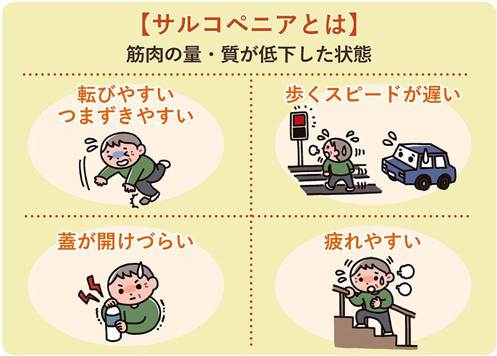 サルコペニア