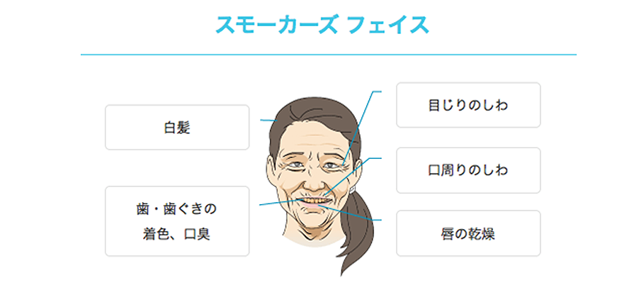 スモーカーズフェイスの特徴