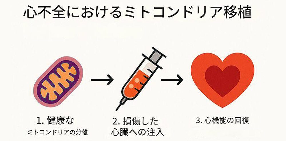 心不全におけるミトコンドリア移植