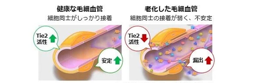 Tie2