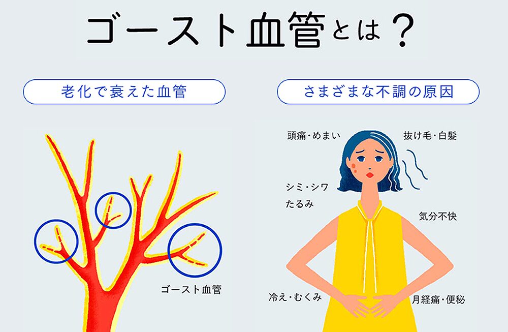 ゴースト血管 とは