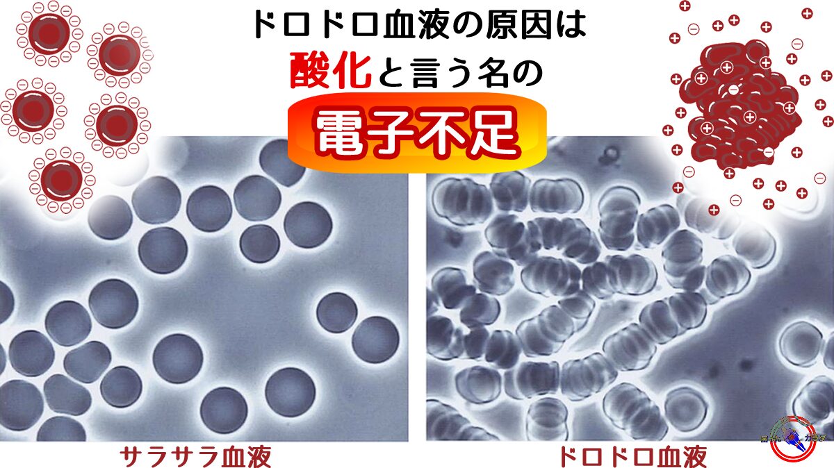 【 ドロドロ血液 の原因は 電子 不足 】 酸化 は 電子 不足と 低酸素状態 でおきる