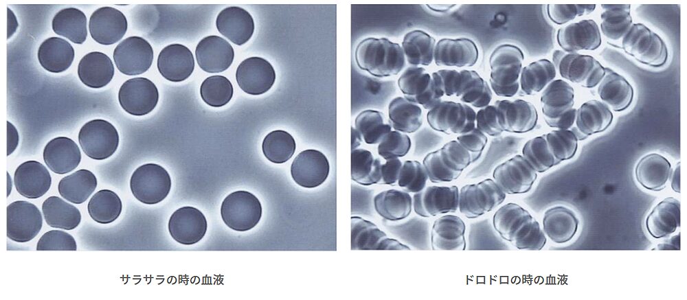 生体血液画像分析