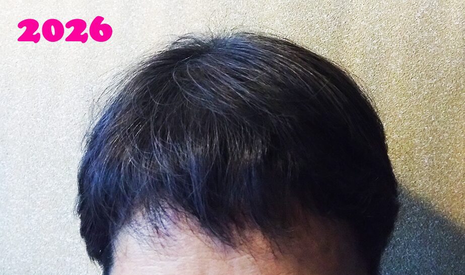 白髪染め1カ月後