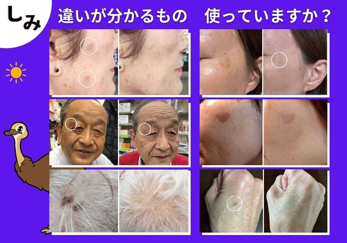 エミューオイルがシミに効く1