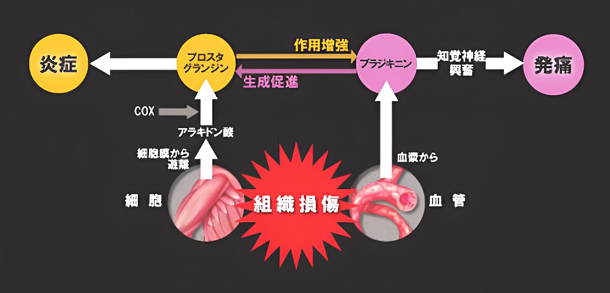 悪玉プロスタグランジン