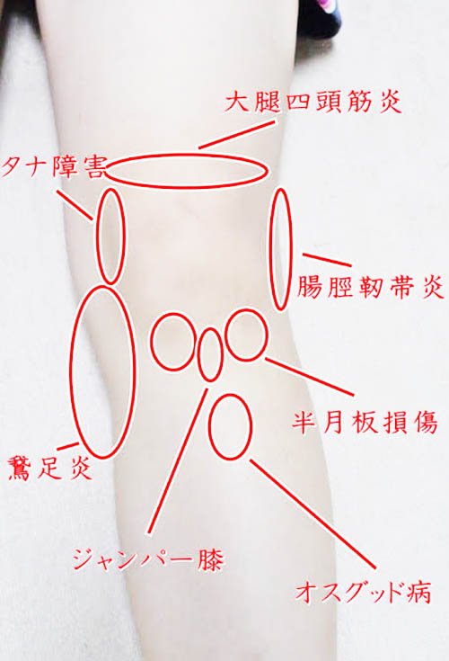 膝の痛み