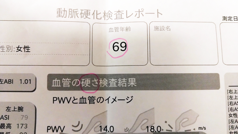 動脈硬化検査レポート